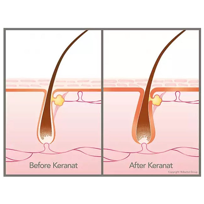 HAAR KOMPLEX PREMIUM | KERANAT™
